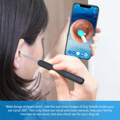 ClearEar Pro : Wireless Smart Ear Vision Cleaner